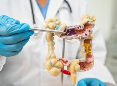Colorectal Cancer